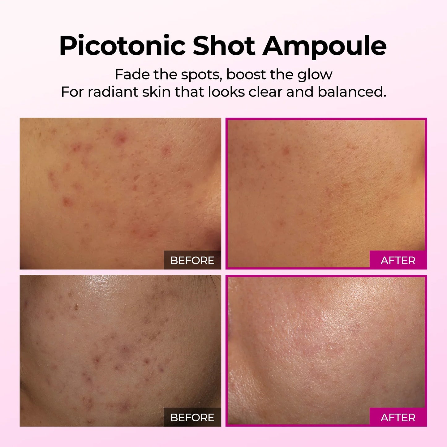 Velyra Picotonic Shot™