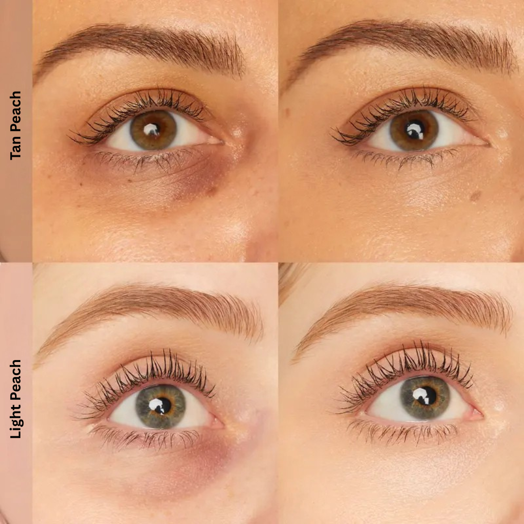 Velyra™ Undereye Corrector